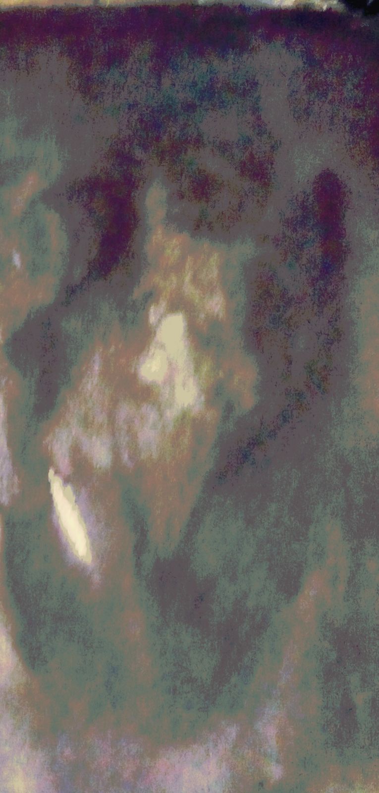 🖼