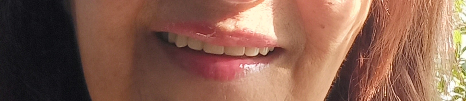 🖼