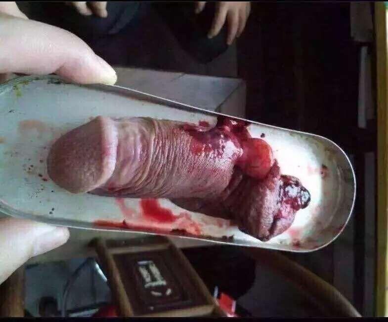 🖼