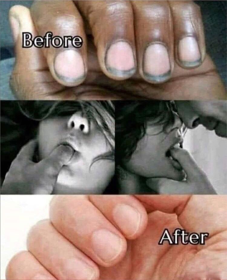 🖼