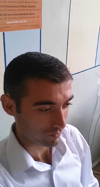Huseyn Allahquliyev
