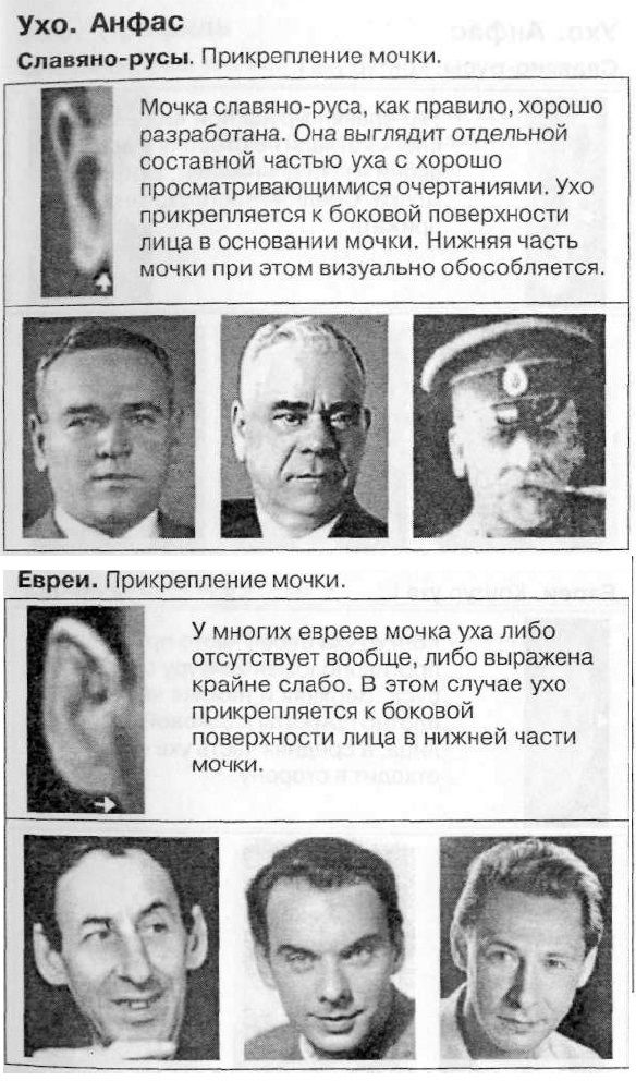 Еврейский мочки ушей у евреев. Мочка уха национальность. Необычная форма ушей у человека. Форма ушей у евреев. Мочка уха национальность.