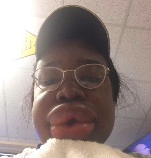 🖼